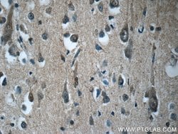 RAB3GAP2 Rabbit anti-Human, Mouse, Rat, Polyclonal, Proteintech:Antibodies:Primary