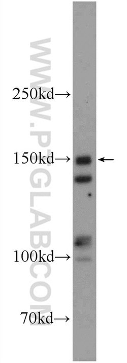 RAB3GAP2 Rabbit anti-Human, Mouse, Rat, Polyclonal, Proteintech:Antibodies:Primary