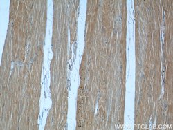 MBNL3 Rabbit anti-Human, Mouse, Polyclonal, Proteintech:Antibodies:Primary