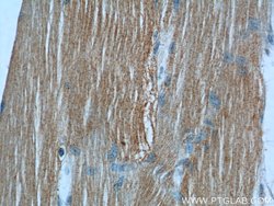 MBNL3 Rabbit anti-Human, Mouse, Polyclonal, Proteintech:Antibodies:Primary