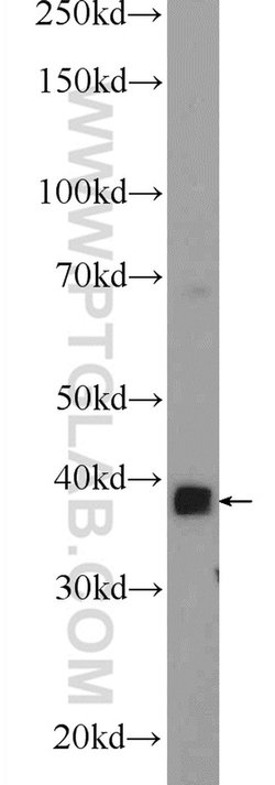 MBNL3 Rabbit anti-Human, Mouse, Polyclonal, Proteintech:Antibodies:Primary