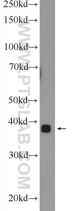 MBNL3 Rabbit anti-Human, Mouse, Polyclonal, Proteintech:Antibodies:Primary