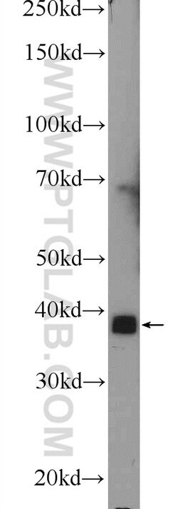 MBNL3 Rabbit anti-Human, Mouse, Polyclonal, Proteintech:Antibodies:Primary