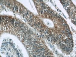 LY6G5B Rabbit anti-Human, Polyclonal, Proteintech 150 &mu;L | Buy Online | Proteintech Group Inc | Fisher Scientific