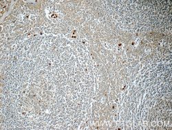 LY6G5B Rabbit anti-Human, Polyclonal, Proteintech 150 &mu;L | Buy Online | Proteintech Group Inc | Fisher Scientific
