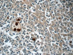 LY6G5B Rabbit anti-Human, Polyclonal, Proteintech 150 &mu;L | Buy Online | Proteintech Group Inc | Fisher Scientific