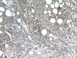 Angiopoietin 2 Rabbit anti-Human, Mouse, Rat, Polyclonal, Proteintech 150