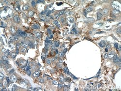 Angiopoietin 2 Rabbit anti-Human, Mouse, Rat, Polyclonal, Proteintech 150