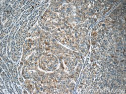 Angiopoietin 2 Rabbit anti-Human, Mouse, Rat, Polyclonal, Proteintech 150