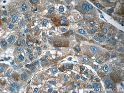 Angiopoietin 2 Rabbit anti-Human, Mouse, Rat, Polyclonal, Proteintech 150