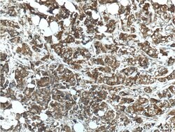 Angiopoietin 2 Rabbit anti-Human, Mouse, Rat, Polyclonal, Proteintech 150