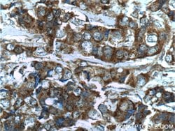 Angiopoietin 2 Rabbit anti-Human, Mouse, Rat, Polyclonal, Proteintech 150