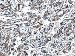 Angiopoietin 2 Rabbit anti-Human, Mouse, Rat, Polyclonal, Proteintech 150