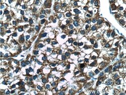 Angiopoietin 2 Rabbit anti-Human, Mouse, Rat, Polyclonal, Proteintech 150