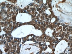 PHF2 Rabbit anti-Human, Polyclonal, Proteintech 150 &mu;L; Unconjugated:Antibodies,