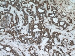 PHF2 Rabbit anti-Human, Polyclonal, Proteintech 150 &mu;L; Unconjugated:Antibodies,