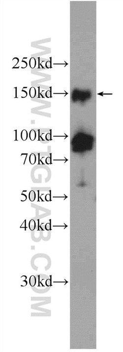 PHF2 Rabbit anti-Human, Polyclonal, Proteintech 150 &mu;L; Unconjugated:Antibodies,