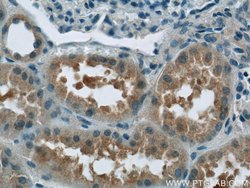 C12orf65 Rabbit anti-Human, Polyclonal, Proteintech:Antibodies:Primary