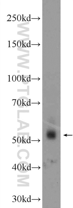 ZNF71 Rabbit anti-Human, Polyclonal, Proteintech 150 &mu;L; Unconjugated:Antibodies,