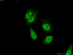 SRA1 Rabbit anti-Human, Polyclonal, Proteintech 150 &mu;L; Unconjugated:Antibodies,