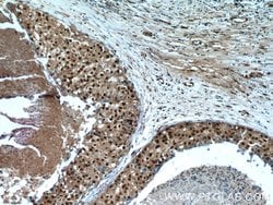 SRA1 Rabbit anti-Human, Polyclonal, Proteintech 150 &mu;L; Unconjugated:Antibodies,