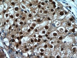 SRA1 Rabbit anti-Human, Polyclonal, Proteintech 150 &mu;L; Unconjugated:Antibodies,
