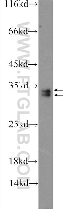 SRA1 Rabbit anti-Human, Polyclonal, Proteintech 150 &mu;L; Unconjugated:Antibodies,