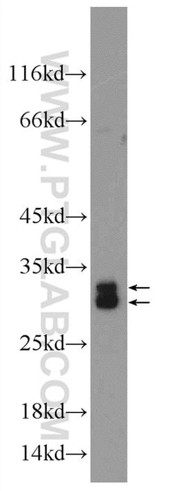 SRA1 Rabbit anti-Human, Polyclonal, Proteintech 150 &mu;L; Unconjugated:Antibodies,