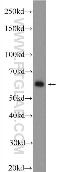 EHD1 Rabbit anti-Human, Mouse, Rat, Polyclonal, Proteintech 150 &mu;L;