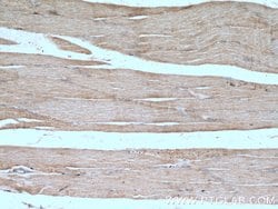 SYNJ1 Rabbit anti-Human, Mouse, Polyclonal, Proteintech 150 &mu;L; Unconjugated:Antibodies,