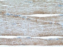 SYNJ1 Rabbit anti-Human, Mouse, Polyclonal, Proteintech 150 &mu;L; Unconjugated:Antibodies,