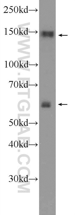 SYNJ1 Rabbit anti-Human, Mouse, Polyclonal, Proteintech 150 &mu;L; Unconjugated:Antibodies,