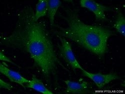 SYNJ1 Rabbit anti-Human, Mouse, Polyclonal, Proteintech 150 &mu;L; Unconjugated:Antibodies,