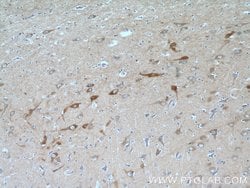 SYNJ1 Rabbit anti-Human, Mouse, Polyclonal, Proteintech 150 &mu;L; Unconjugated:Antibodies,