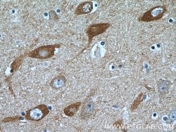 SYNJ1 Rabbit anti-Human, Mouse, Polyclonal, Proteintech 150 &mu;L; Unconjugated:Antibodies,