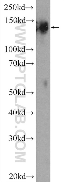 SYNJ1 Rabbit anti-Human, Mouse, Polyclonal, Proteintech 150 &mu;L; Unconjugated:Antibodies,
