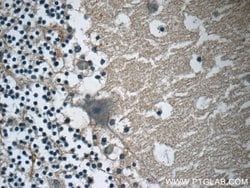 AMMECR1 Rabbit anti-Human, Mouse, Polyclonal, Proteintech 20 &mu;L; Unconjugated:Antibodies,