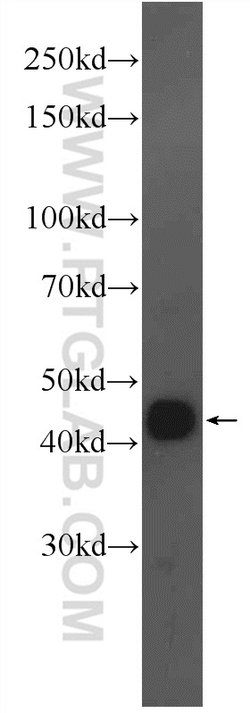 AMMECR1 Rabbit anti-Human, Mouse, Polyclonal, Proteintech 20 &mu;L; Unconjugated:Antibodies,