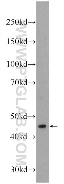AMMECR1 Rabbit anti-Human, Mouse, Polyclonal, Proteintech 20 &mu;L; Unconjugated:Antibodies,