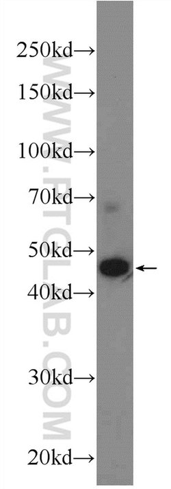 AMMECR1 Rabbit anti-Human, Mouse, Polyclonal, Proteintech 20 &mu;L; Unconjugated:Antibodies,