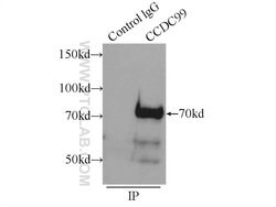CCDC99 Rabbit anti-Human, Polyclonal, Proteintech 150 &mu;L; Unconjugated:Antibodies,