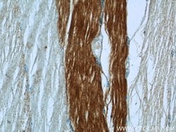 MN1 Rabbit anti-Human, Polyclonal, Proteintech:Antibodies:Primary Antibodies