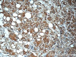 MN1 Rabbit anti-Human, Polyclonal, Proteintech:Antibodies:Primary Antibodies