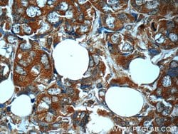 MN1 Rabbit anti-Human, Polyclonal, Proteintech:Antibodies:Primary Antibodies