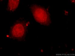 HELB Rabbit anti-Human, Polyclonal, Proteintech:Antibodies:Primary Antibodies