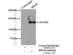 HELB Rabbit anti-Human, Polyclonal, Proteintech:Antibodies:Primary Antibodies