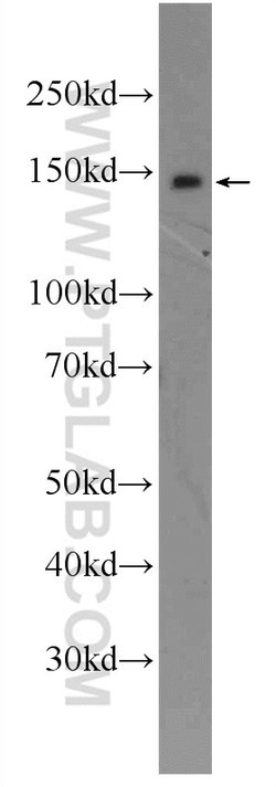 Proteintech HELB Rabbit anti-Human, Polyclonal, Proteintech