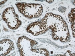 RNF151 Rabbit anti-Human, Mouse, Rat, Polyclonal, Proteintech 150 μL;