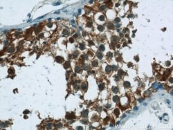 RNF151 Rabbit anti-Human, Mouse, Rat, Polyclonal, Proteintech 150 μL;