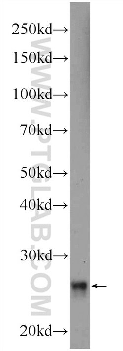 RNF151 Rabbit anti-Human, Mouse, Rat, Polyclonal, Proteintech 150 μL;